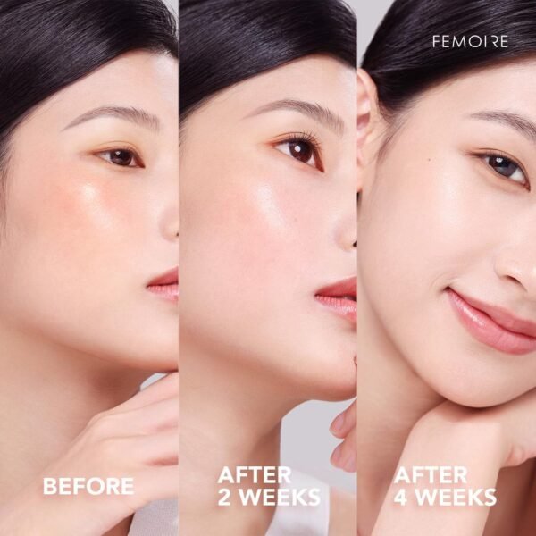 IMAGE 2024-07-09 18:16:42 Femoire Wellous | Atome Installment | Wellous Singapore